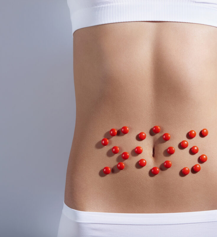 APENDICITE: O QUE É E TRATAMENTO